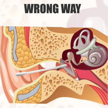 24 Reusable Sticky Ear wax Cleaning Buds (EWR2) - Image 4