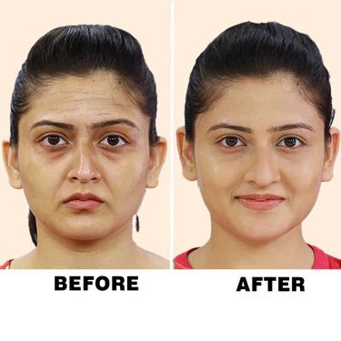 Anti-ageing Youthful Skin Roller (FR) - Image 4