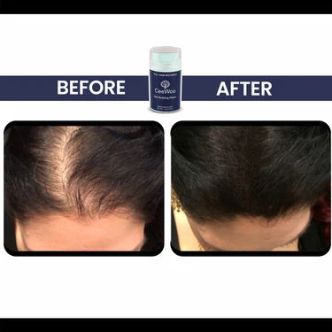CeeWoo Hair Building Fiber - Image 6