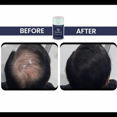 CeeWoo Hair Building Fiber - Image 7