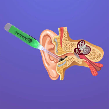 Earwax Cleaner With Flashlight Buy 1 Get 1 Free (EDC2) - Image 3
