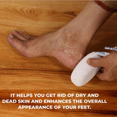 Foot Mask - For Brightening, Crack Heel & Dead Skin Remover + Pumice Stone (CFCK) - Image 5