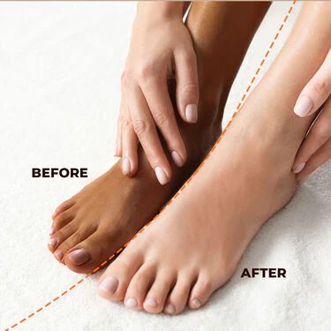 Foot Mask - For Brightening, Crack Heel & Dead Skin Remover + Pumice Stone (CFCK) - Image 8