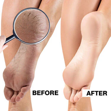 Instant Foot Filer (FF1) - Image 8