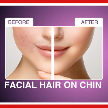 Painless Eyebrow And Face Hair Trimmer - Image 6