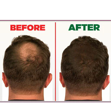 Quick And Easy Hair Gap Solution - Image 8