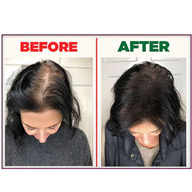 Quick And Easy Hair Gap Solution - Image 9