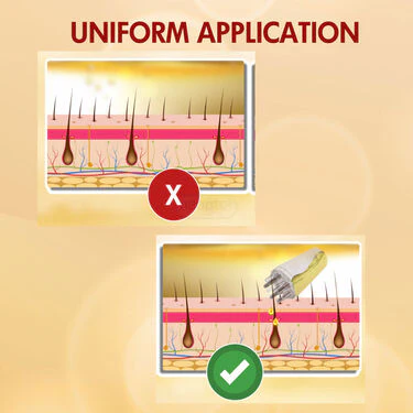 Scalp Oil Applier (OA) - Image 3