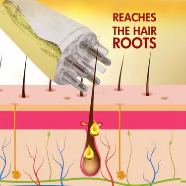 Scalp Oil Applier (OA) - Image 4