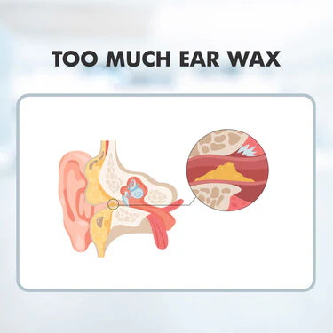 Sound Increaser for Ear (HE01) - Image 3