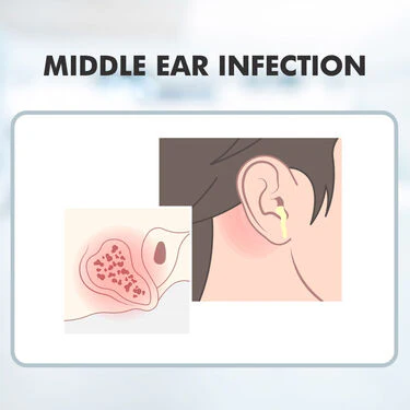 Sound Increaser for Ear (HE01) - Image 7
